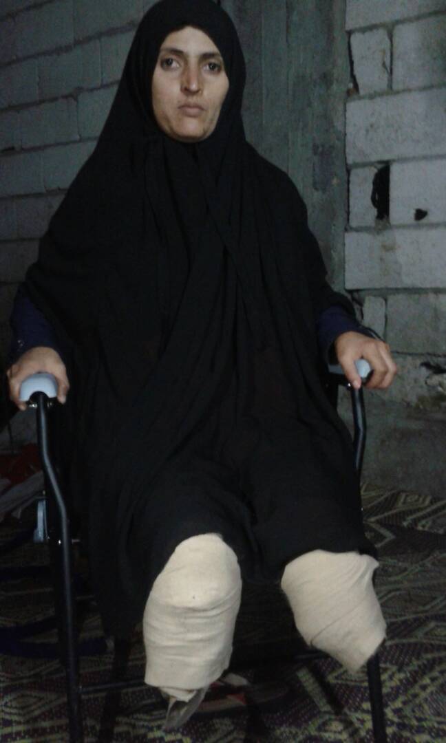 49061-دليلة-خسرت-ساقيها-بسبب-لغم