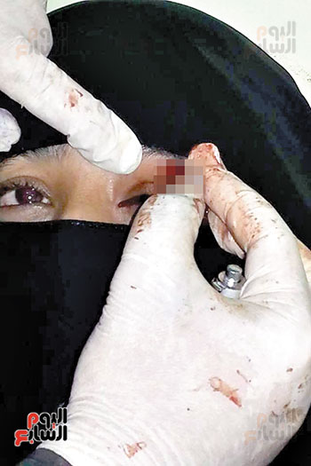36375-اليوم-السابع-فى-اليمن-(4)